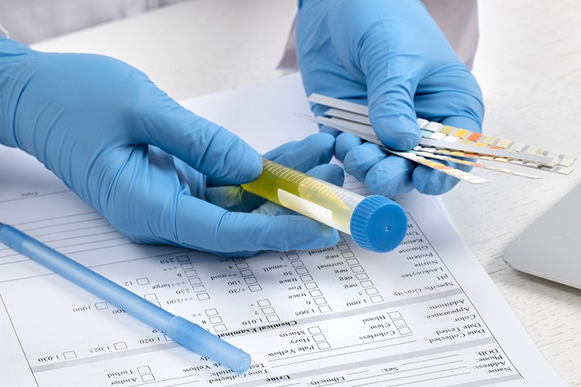 Exámenes toxicologicos